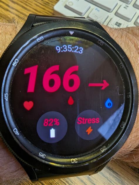 dexcom g7 watch face